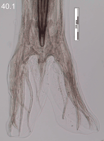 Ashworthius sidemi 