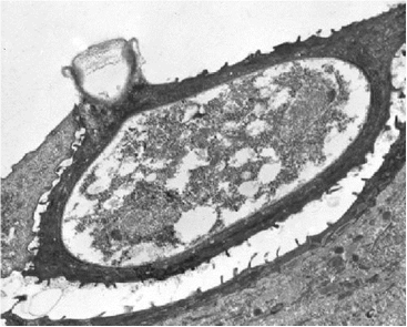  - - <i>Batrachochytrium dendrobatidis</i> Longcore Pessier & D.K. Nichols, 1999