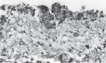  - - <i>Batrachochytrium dendrobatidis</i> Longcore Pessier & D.K. Nichols, 1999